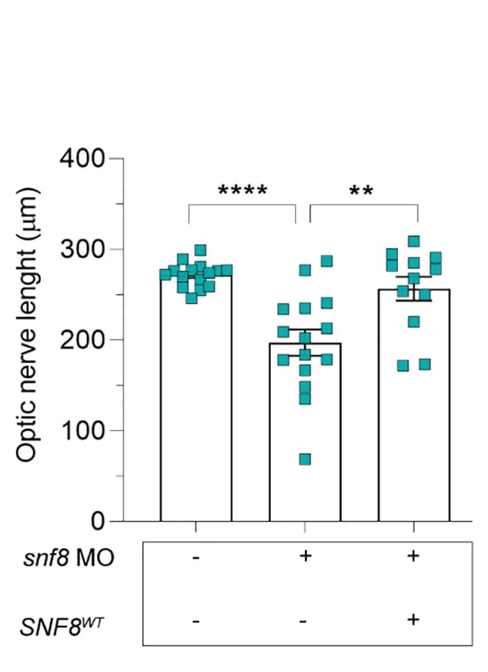 Open access visualization of Error Bars, Bar Plot, Quantification, Optic Nerve, One-way ANOVA