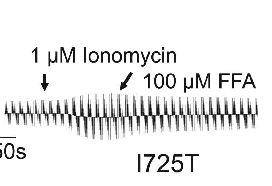 Open access visualization of Line Plot, HEK293 Cells, ANO4, Ile725Thr, Ionomycin