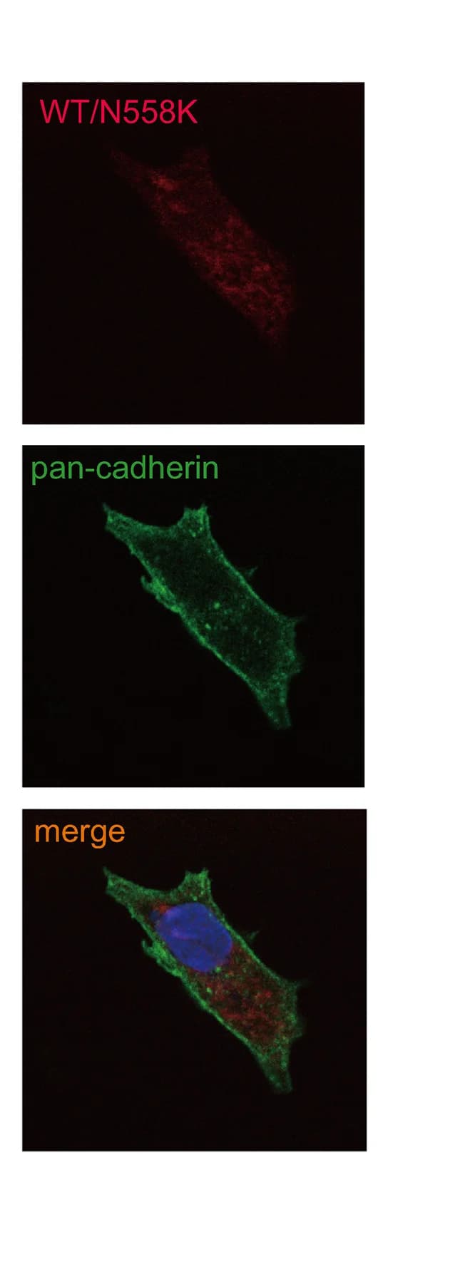Open access visualization of Microscopy, HEK293 Cells, Immunostaining, Wild-Type/Val528Met, Wild-Type/Asn558Lys
