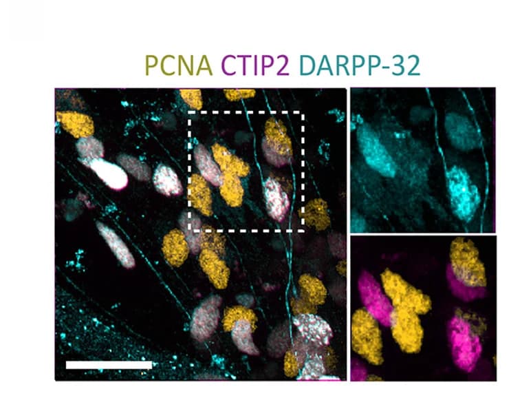 Open access visualization of Microscopy, Immunostaining, PCNA, CTIP2, DARPP-32
