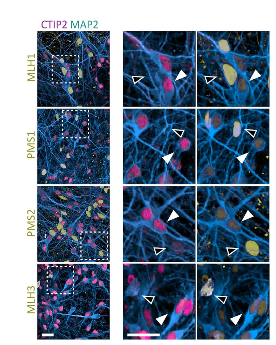 Open access visualization of Microscopy, Immunostaining, CTIP2, MAP2, MMR Factor