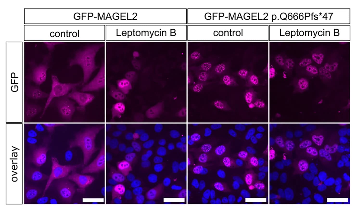 Open access visualization of Microscopy, HeLa Cells, Transfection, GFP-tagged MAGEL2, MAGEL2c.1996dupC Mutant