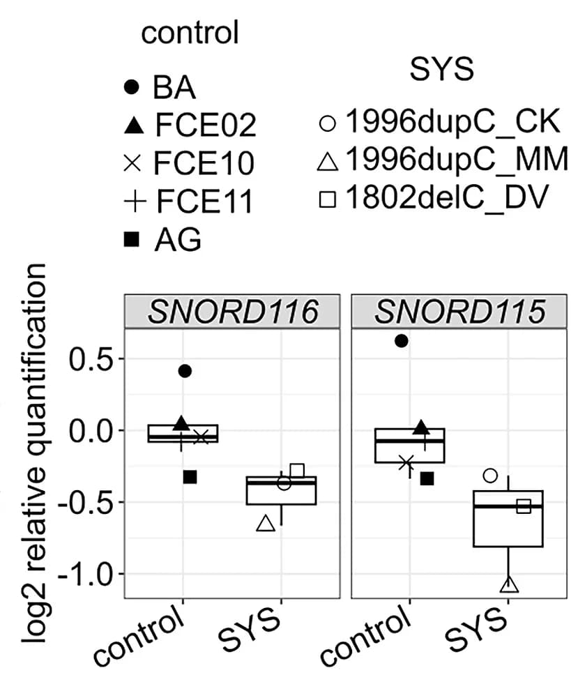 Open access visualization of Box Plot, Scatter Plot, Northern Blot, Band Quantification, 5S rRNA