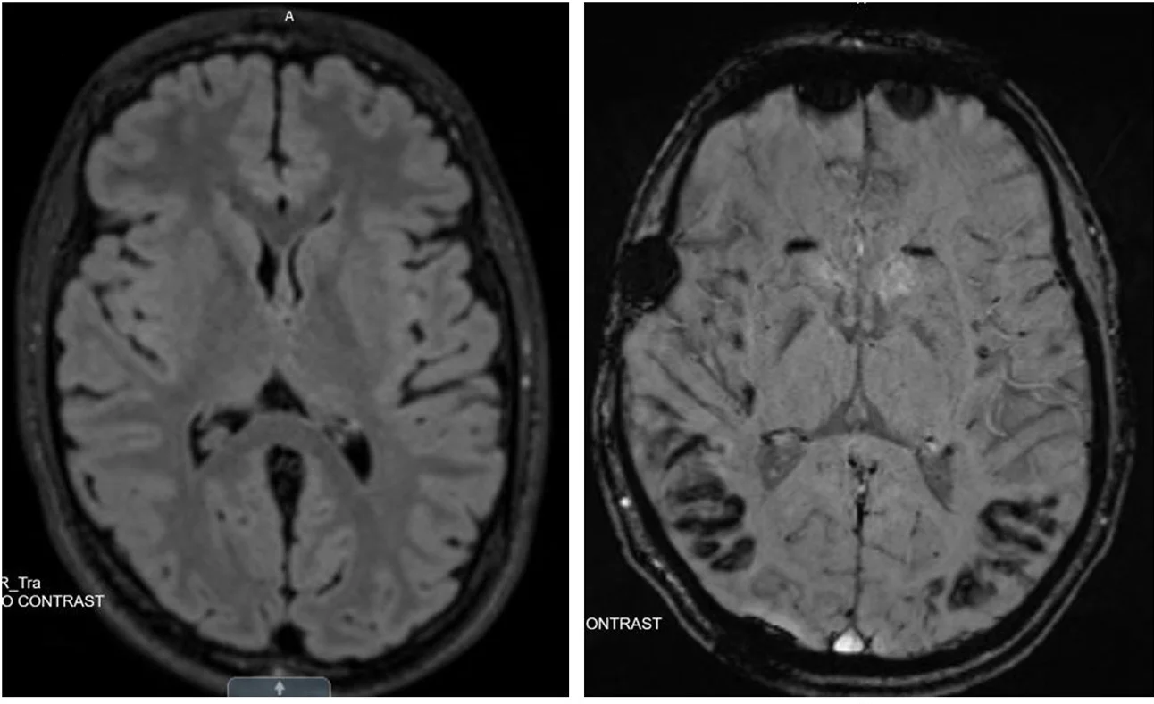 Open access visualization of Microscopy, Magnetic Resonance, Brain Images, Axial Section, Control