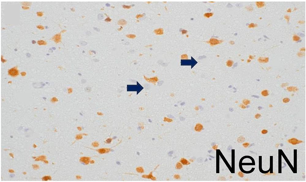 Open access visualization of Microscopy, Immunostaining, Architectural Disarray, Cortical Dyslamination, NeuN