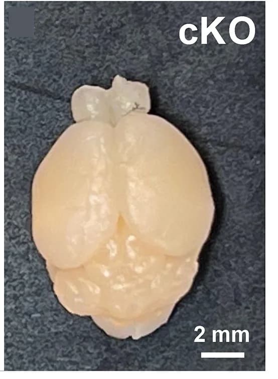 Open access visualization of Photo, Wild-Type Brain, Conditional KO Brain, Microcephaly