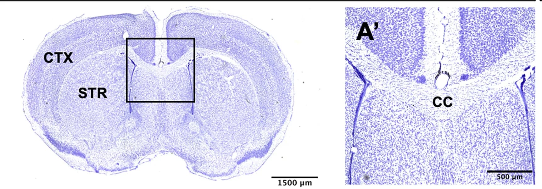 Open access visualization of Microscopy, Nissl Staining, Wild-Type Brain, Serial Sections, Brain