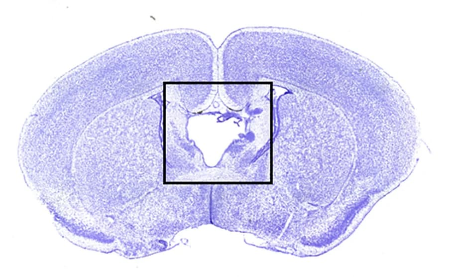 Open access visualization of Microscopy, cKO Sections, Rostral, Caudal, cKO Brains