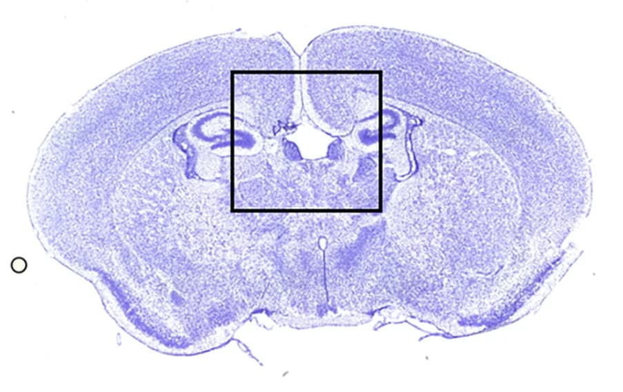Open access visualization of Microscopy, cKO Sections, Rostral, Caudal, cKO Brains