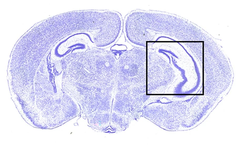 Open access visualization of Microscopy, cKO Sections, Rostral, Caudal, cKO Brains