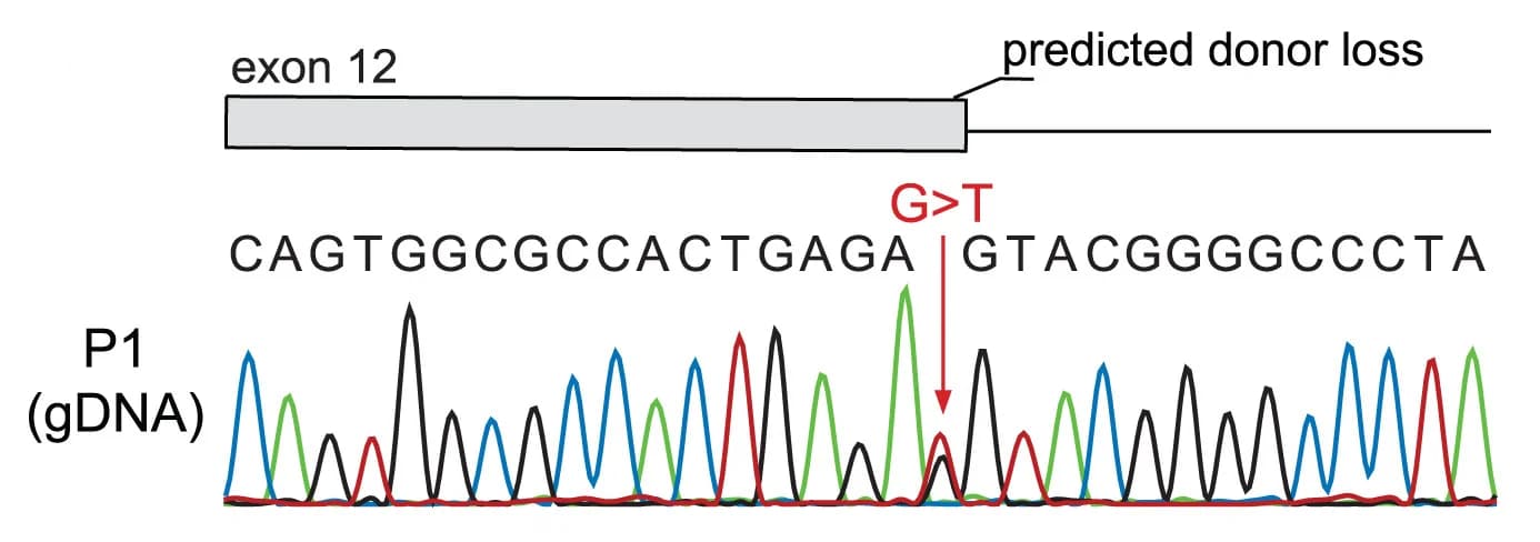 Open access visualization of Line Plot, AP5Z1, Exon, Intron, Genomic DNA