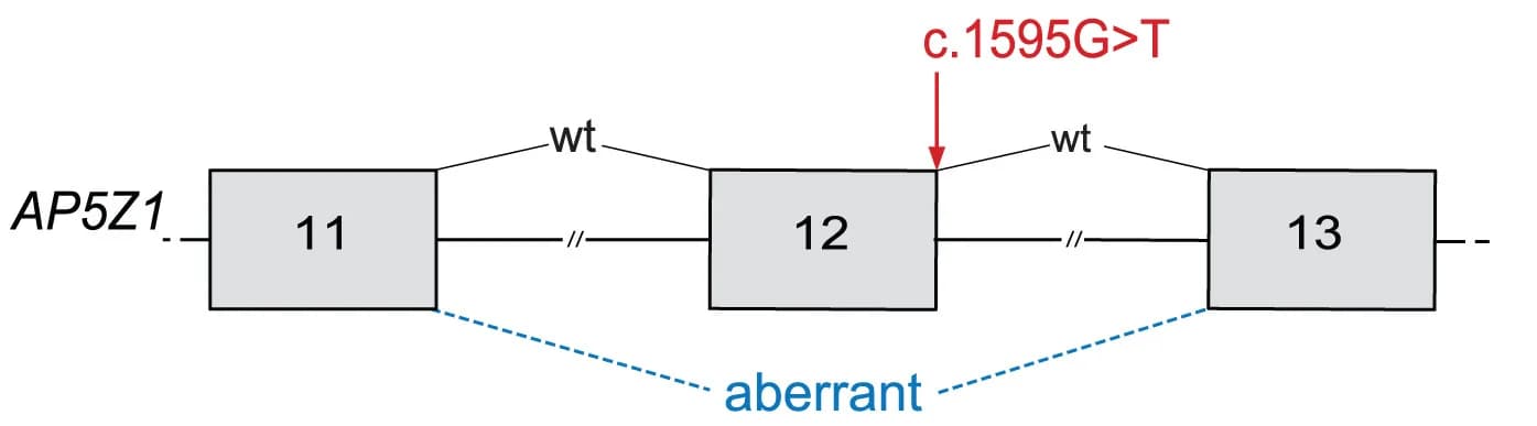 Open access visualization of Workflow, Flowchart, AP5Z1, Exon, Variant