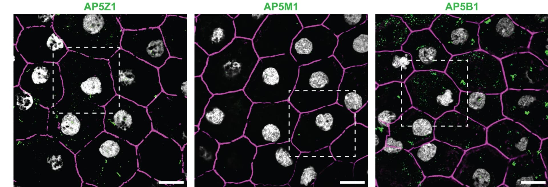 Open access visualization of Microscopy, AP5Z1, AP5M1, AP5B1, RPE Cells
