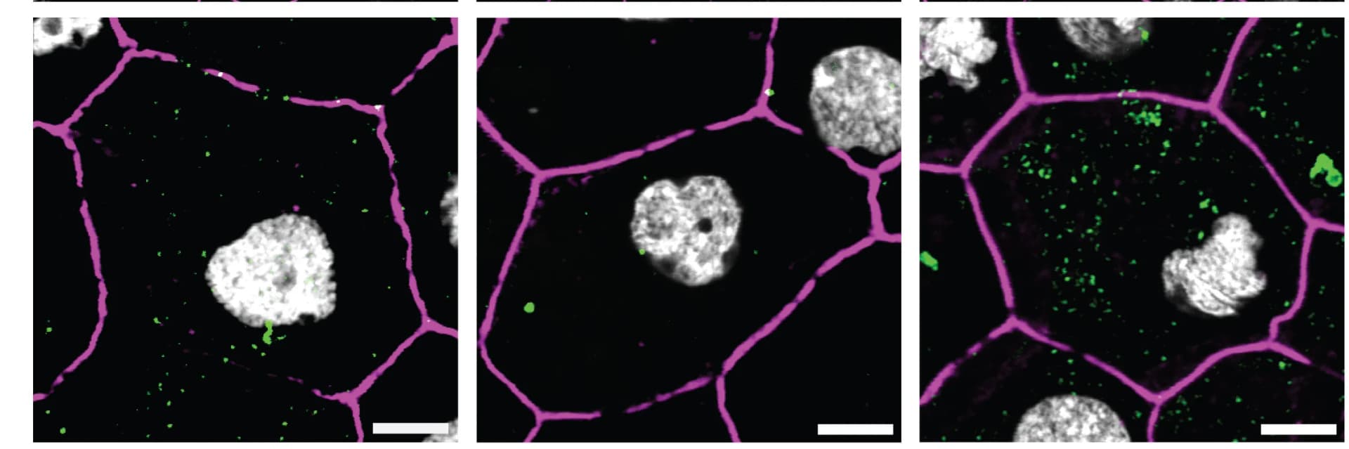 Open access visualization of Microscopy, AP5Z1, AP5M1, AP5B1, RPE Cells