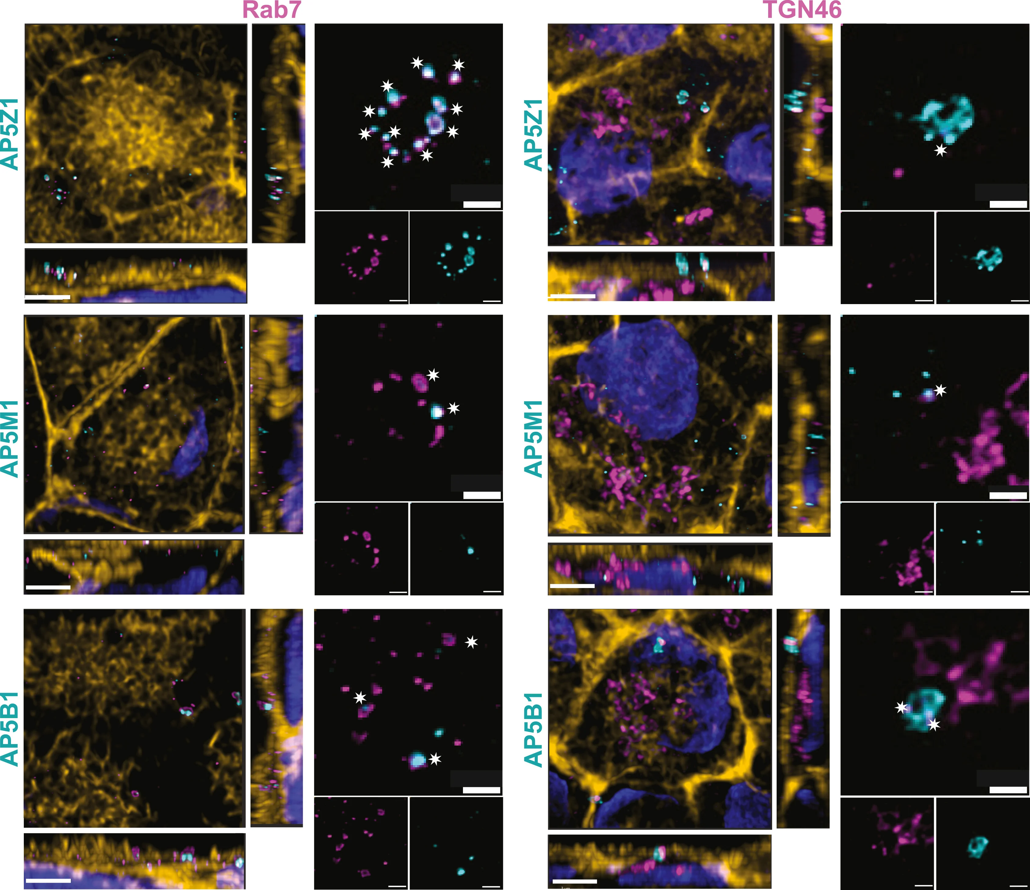 Open access visualization of Microscopy, Immunofluorescence, iPSC-derived RPE Monolayer, AP-5 Components, Rab7