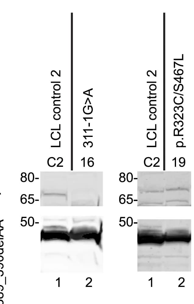Open access visualization of Gel, Immunoblot, Lysates, Lymphoblast Cell Lines, Control