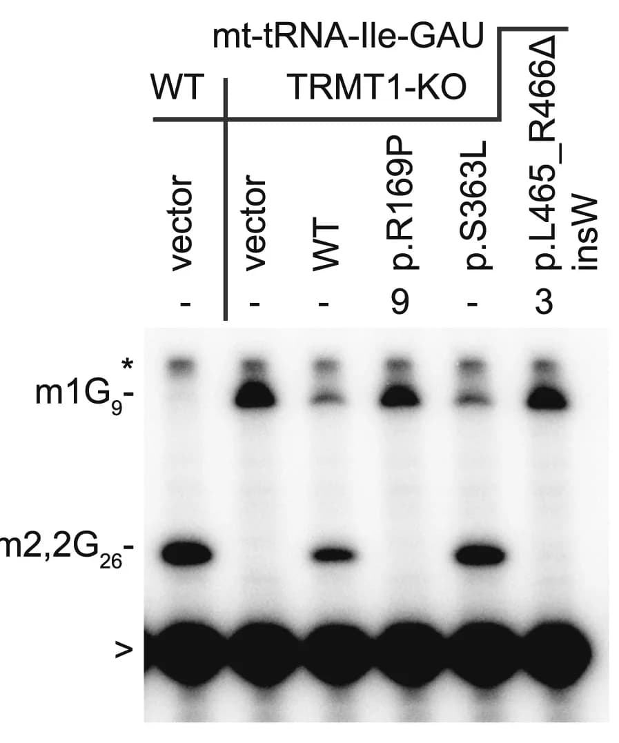 Open access visualization of Gel, Primer Extension Gels, tRNA-Met-CAU, mt-tRNA-Ile-GAU, 293T Cell Lines