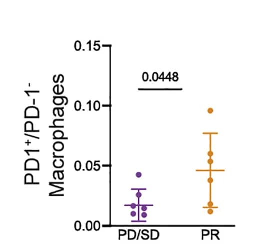 Open access visualization of Scatter Plot, Error Bars, PD-1+Macrophages, Atezolizumab Therapy, Progressive Disease