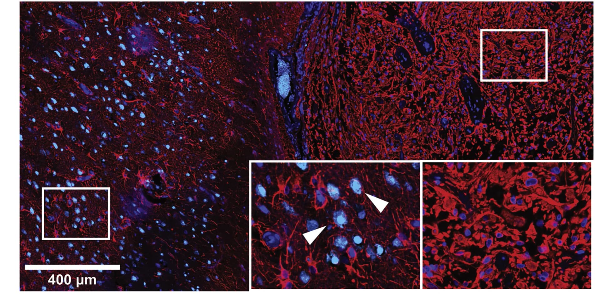 Open access visualization of Microscopy, IF Staining, GFAP, NEUN, DAPI