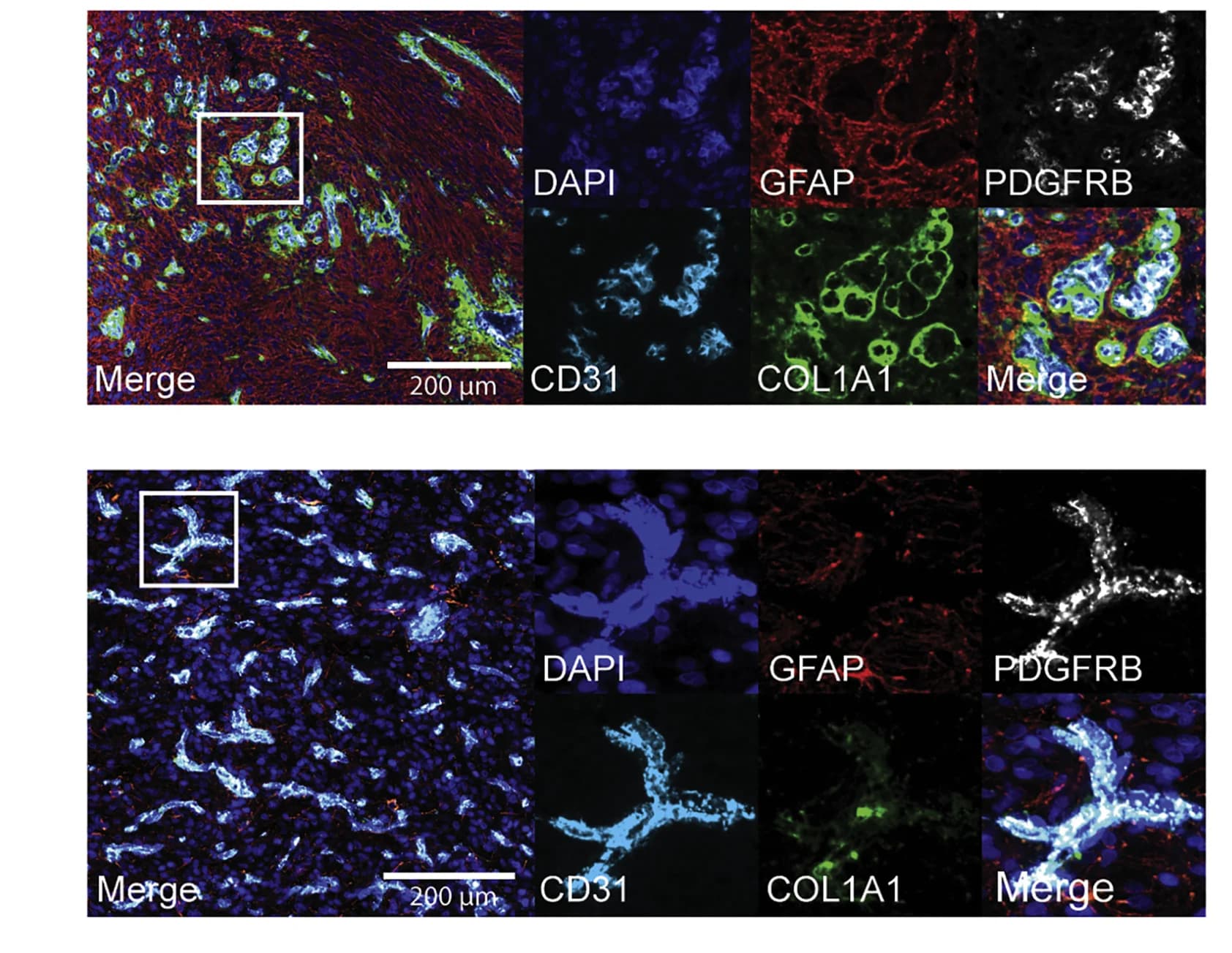 Open access visualization of Microscopy, DAPI, Immunofluorescence Staining, Endothelial Cells, CD31
