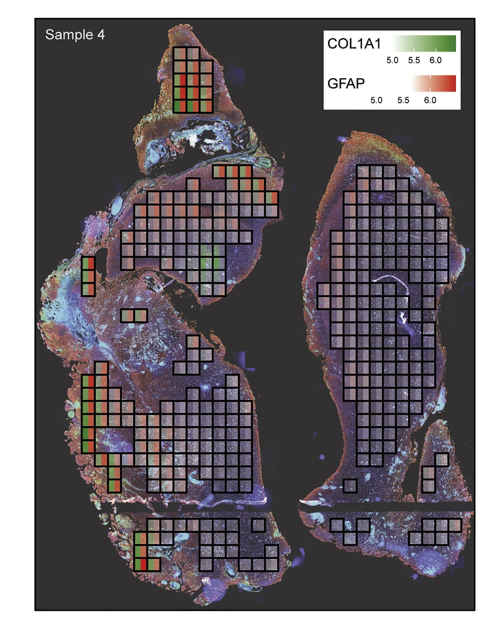 Open access visualization of Heatmap, Quantification, Immunofluorescence Staining, COL1A1, GFAP