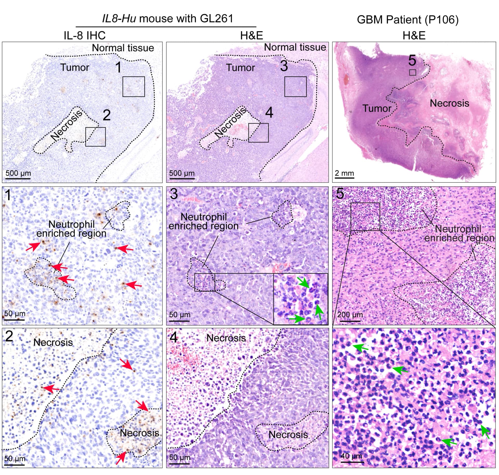 Open access visualization of Microscopy, IL-8 IHC, H&E Staining, Serial Sections, GL261 Tumors