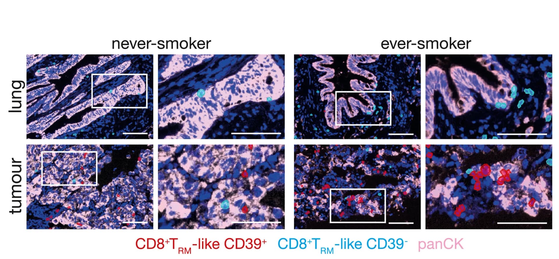 Open access visualization of Microscopy, Lung, Tumors, CD39, CD8+TRM-like Cells