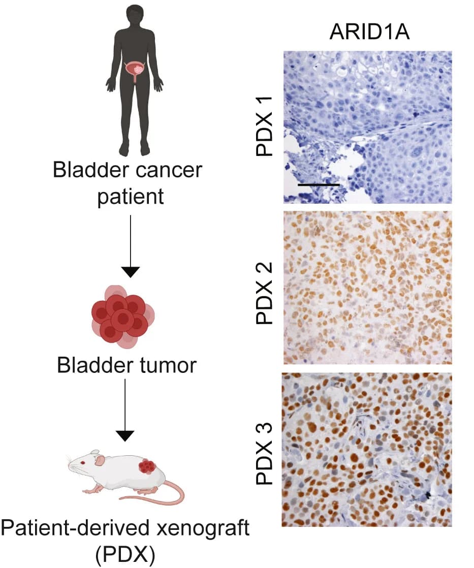 Open access visualization of Workflow, Microscopy, Patient-Derived Xenograft Model, ARID1A, Tumor Tissues