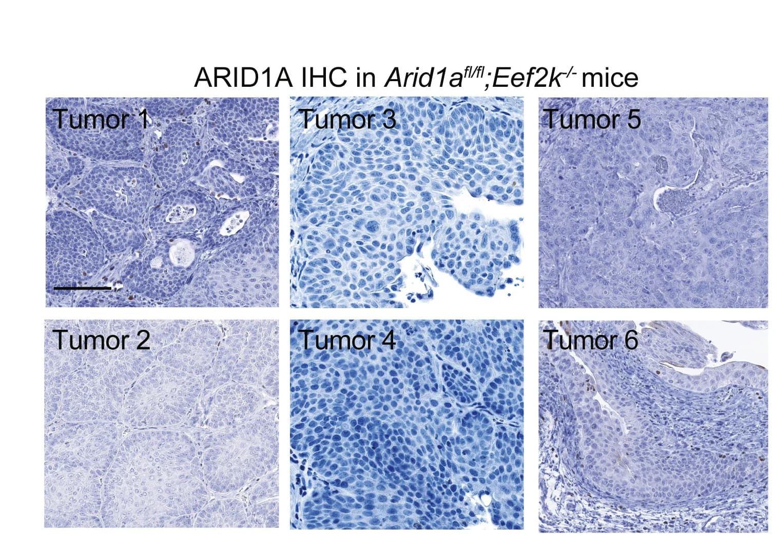 Open access visualization of Microscopy, ARID1A IHC, Arid1afl/fl Mouse, Eef2k-/- Mouse, Tumors