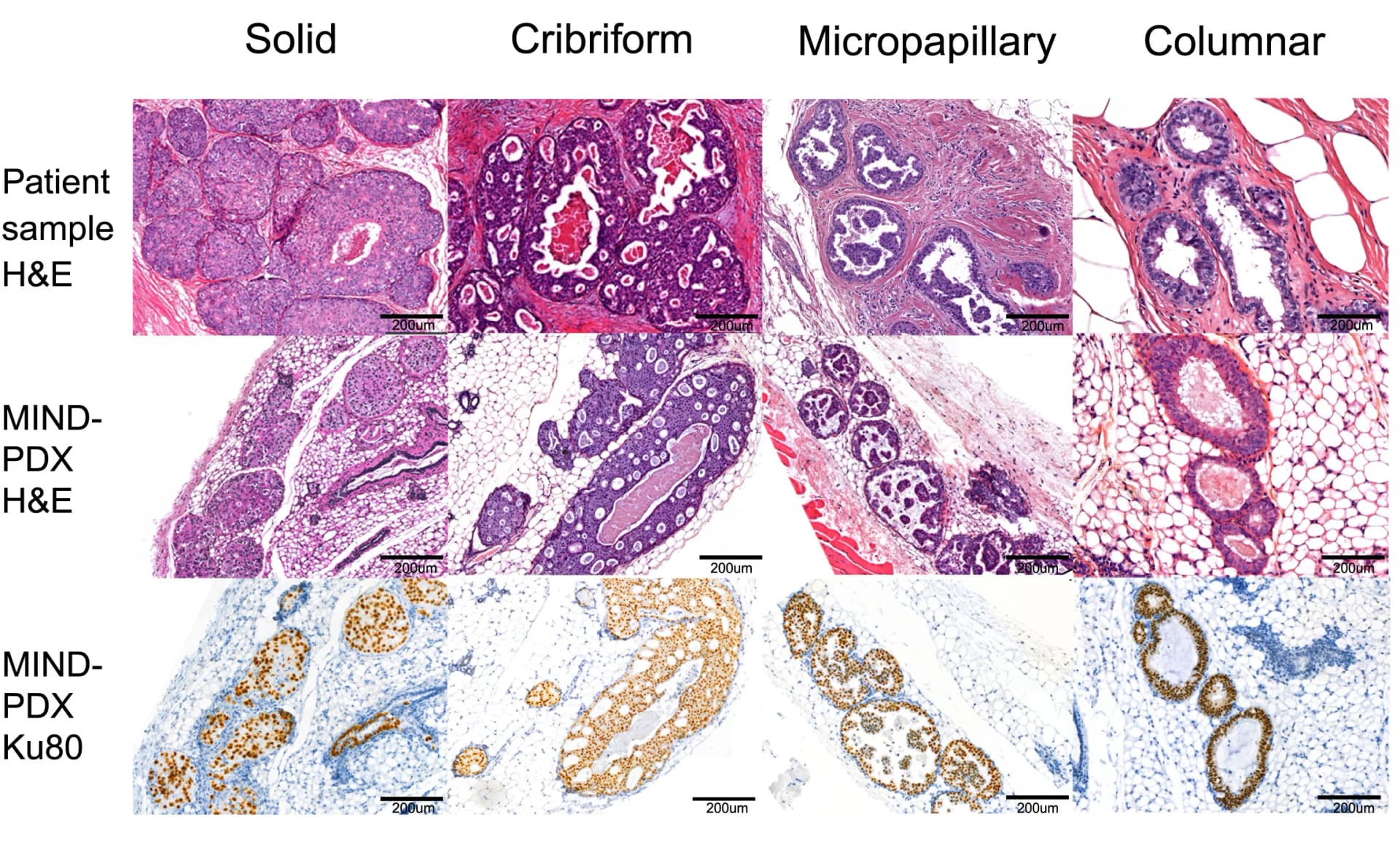 Open access visualization of Microscopy, H&E Staining, Growth Patterns, Primary DCIS Lesions, DCIS-MIND Outgrowths