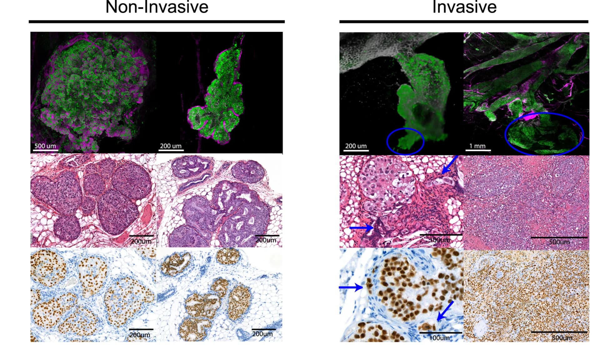 Open access visualization of Microscopy, Whole-mount analysis, H&E staining, Ku80 staining, DCIS-MIND lesions