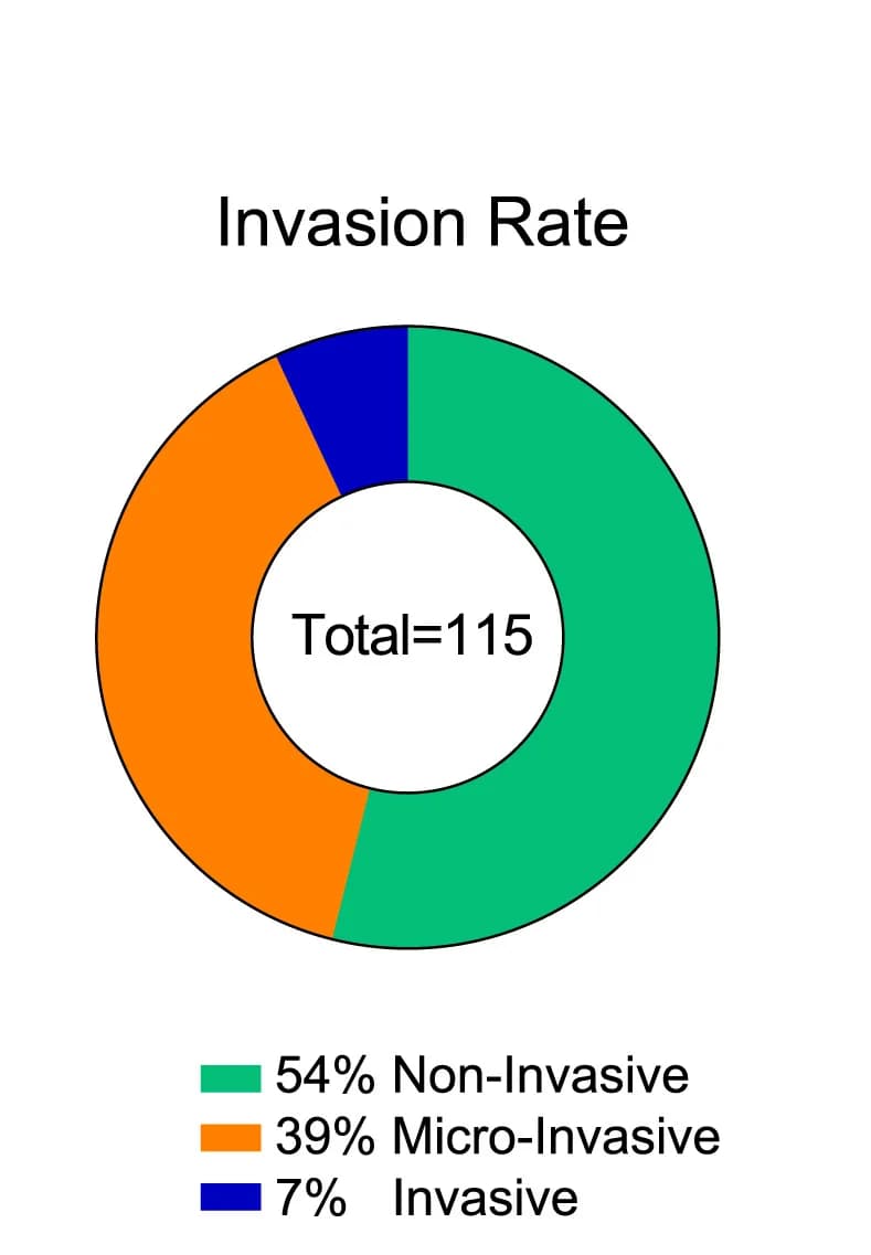 Open access visualization of Donut Chart, Pie chart, DCIS-MIND lesions, Non-invasive growth, Micro-invasion