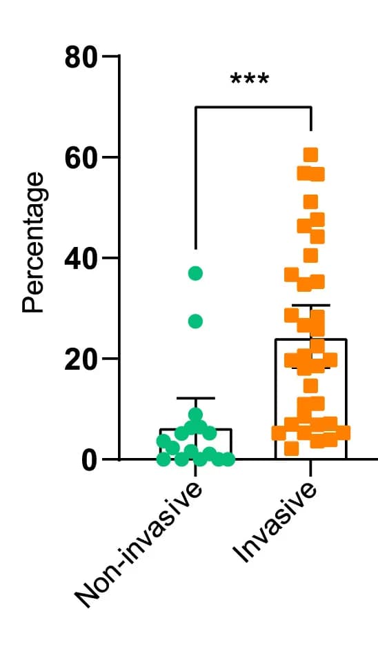 Open access visualization of Box Plot, Scatter Plot, Copy Number Alterations, DCIS-MIND Lesions, Invasive Progression