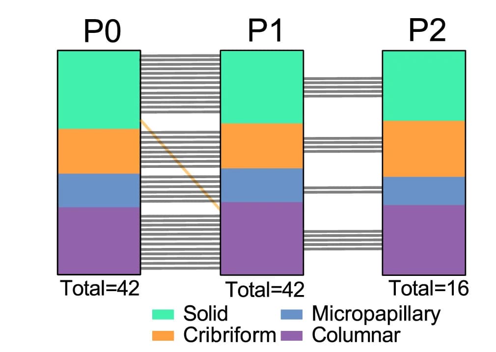 Open access visualization of Stacked Bar Plot, Sankey, Growth Pattern, DCIS Lesions, Serial Transplantation