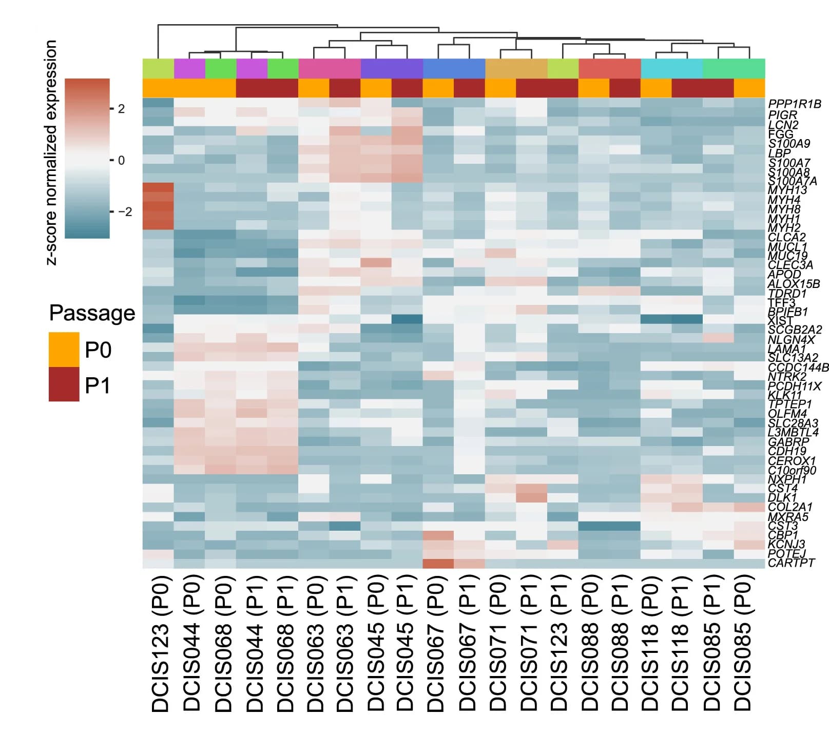 Open access visualization of Heatmap, Clustered, Unsupervised Clustering, Gene Expression Profiles, DCIS Models