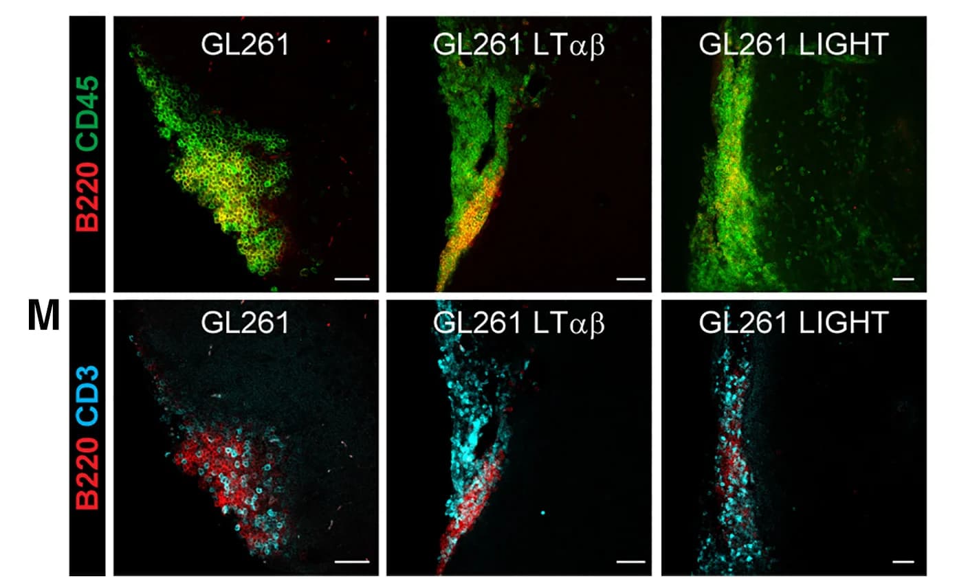 Open access visualization of Microscopy, Immunofluorescence Images, CD45+B220+TLS