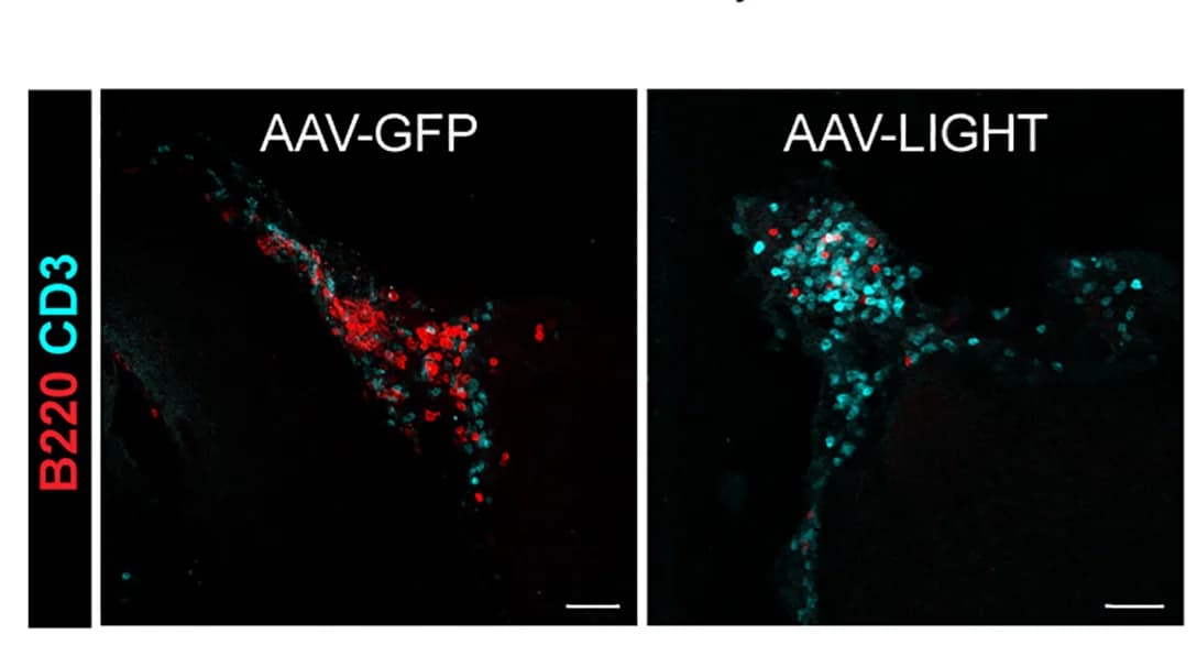Open access visualization of Microscopy, Immunofluorescence images, CD3+T cells, B220+B cells, Tumor-bearing mice