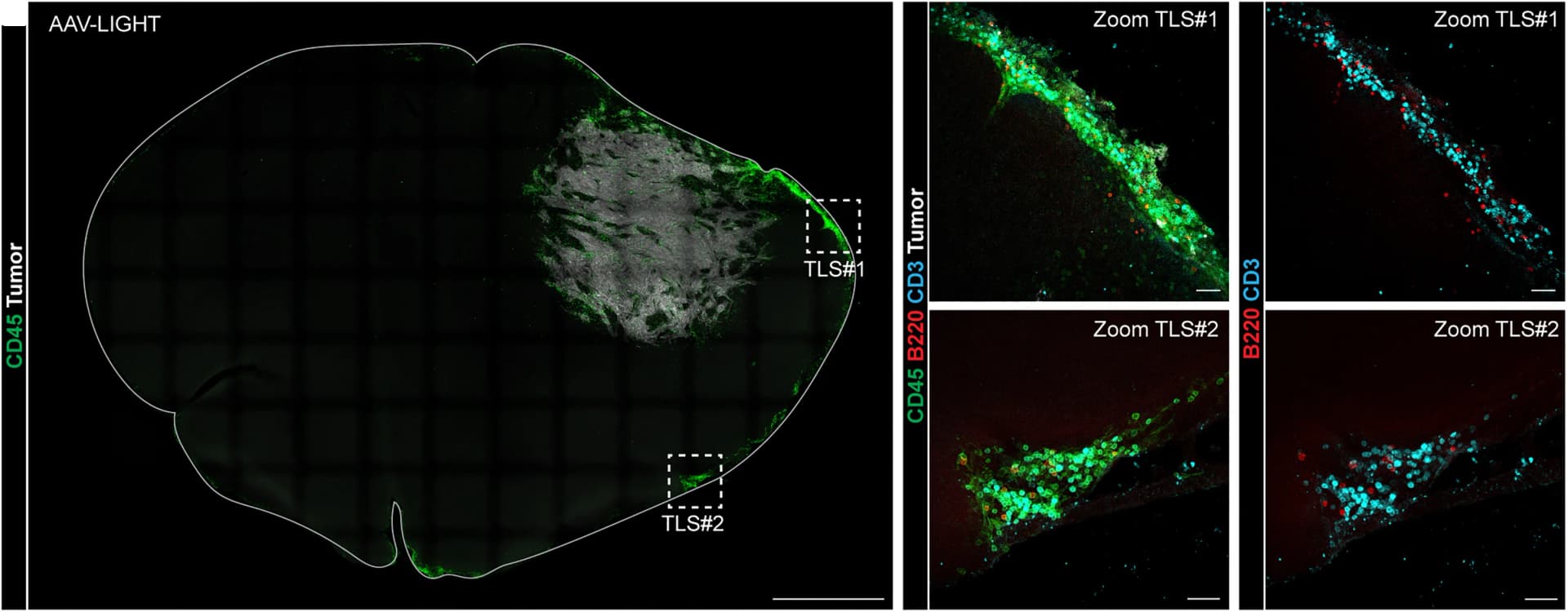 Open access visualization of Microscopy, Immunofluorescence, Mouse Brain, CT-2A Tumor, AAV-LIGHT Treatment