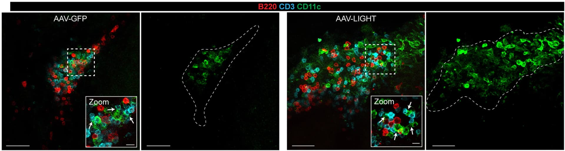Open access visualization of Microscopy, Immunofluorescence, CD11c+DCs, CD3+B220+TLS, Dendritic Cells