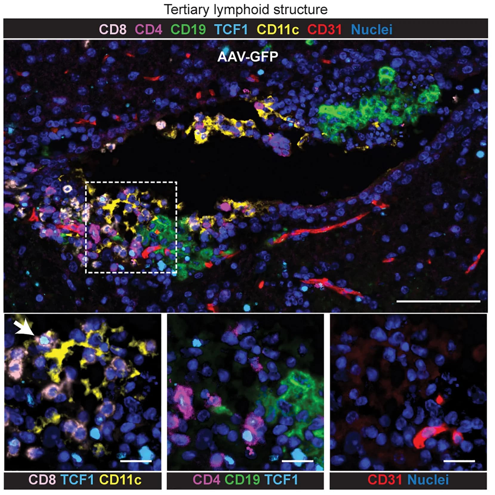 Open access visualization of Microscopy, Multispectral Staining, TCF1+CD8+ Stem-like Cells, TLS, Brain