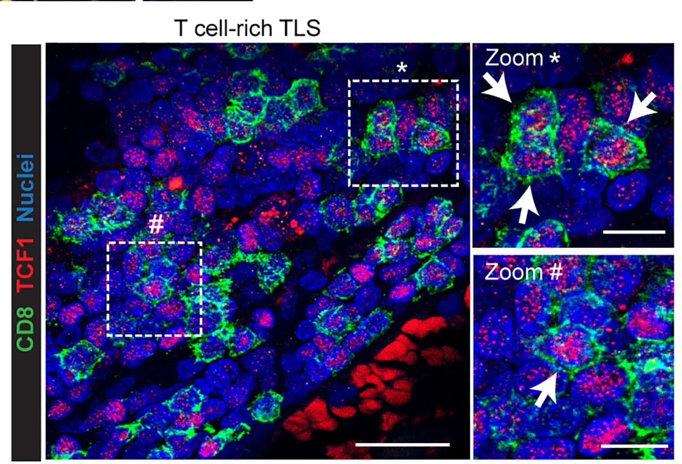 Open access visualization of Microscopy, CD8, TCF1, TLS