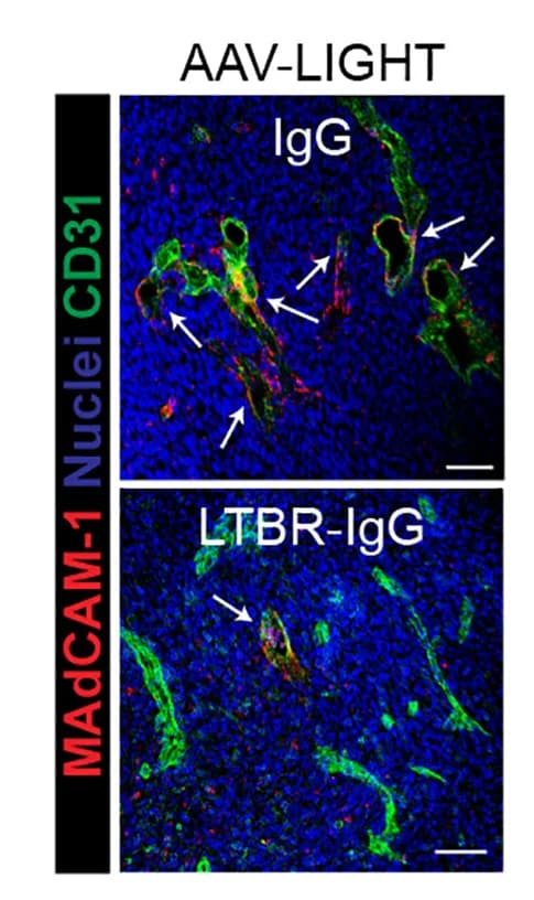 Open access visualization of Microscopy, Immunofluorescence images, TA-HEVs, Tumor Vessels