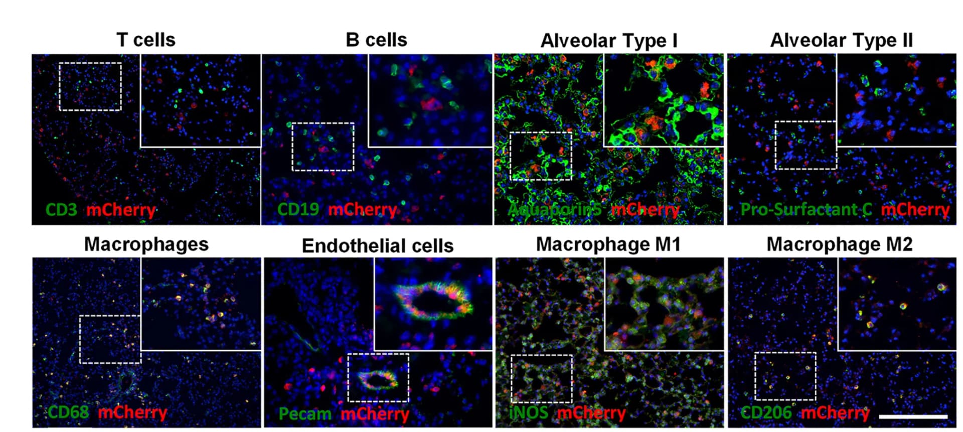 Open access visualization of Microscopy, Immunofluorescence, mCherry, KY-FDR Lungs, Tumor Induction