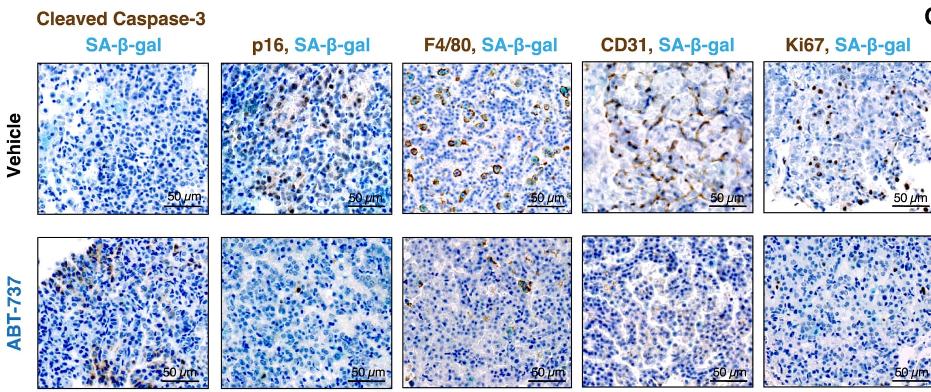Open access visualization of Microscopy, Immunohistochemistry, Lung Tumors, KrasFSFG12V/+ Mice, SA-β-gal Activity Assay