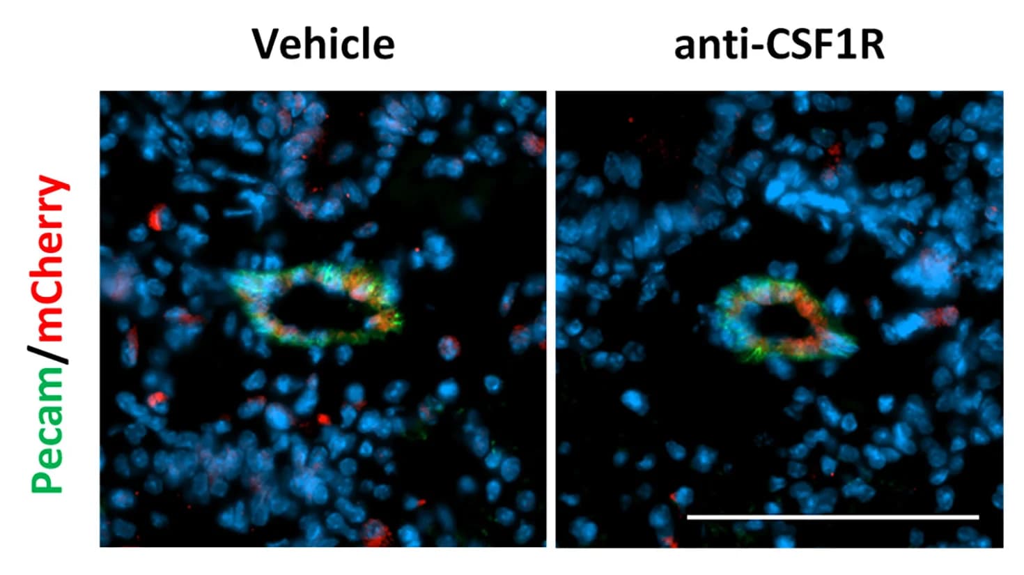 Open access visualization of Microscopy, Co-immunostaining, mCherry, PECAM, Tumor-bearing Lungs