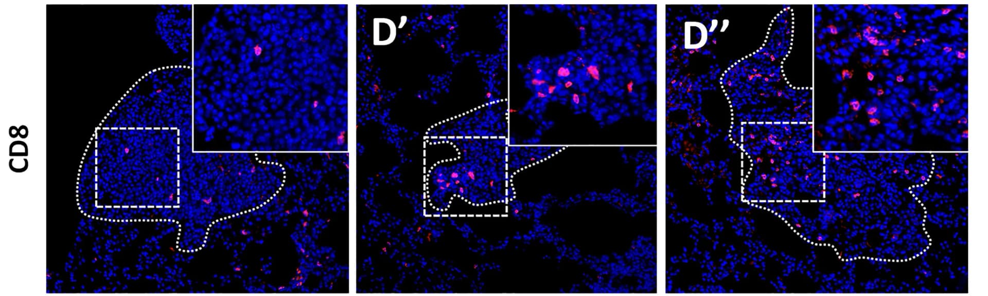 Open access visualization of Microscopy, Immunofluorescence, CD8, Tumorigenic KY-FDR Lungs, Vehicle