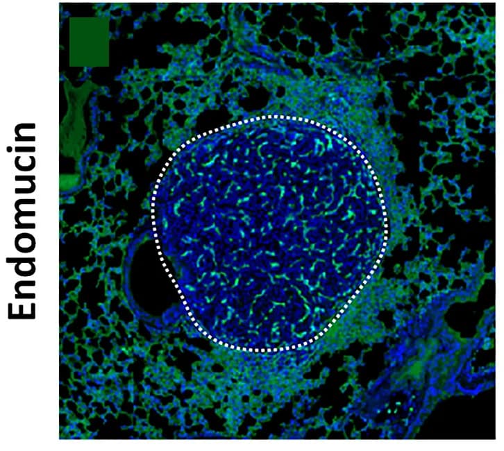 Open access visualization of Microscopy, Immunofluorescence, Endomucin, Tumorigenic KY-FDR Lungs, Vehicle