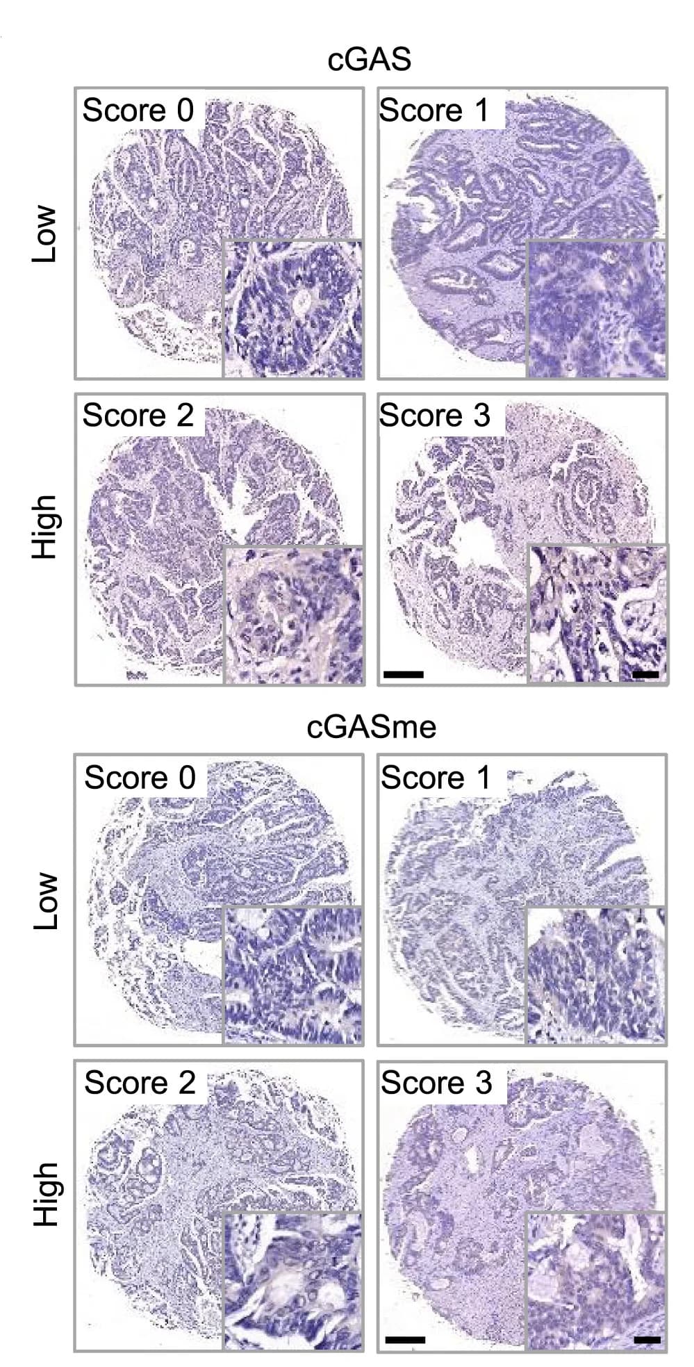 Open access visualization of Microscopy, cGAS, cGAS Methylation, Immunohistochemistry, Tumor Tissue