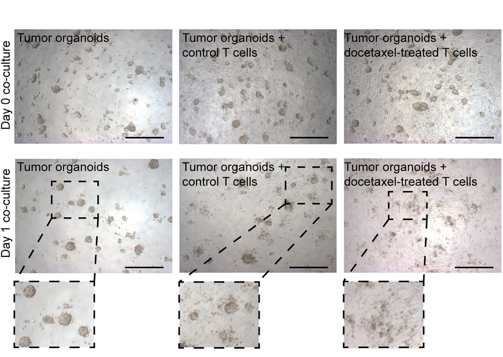 Open access visualization of Microscopy, Photo, Lung Cancer Organoids, T Cells, Docetaxel