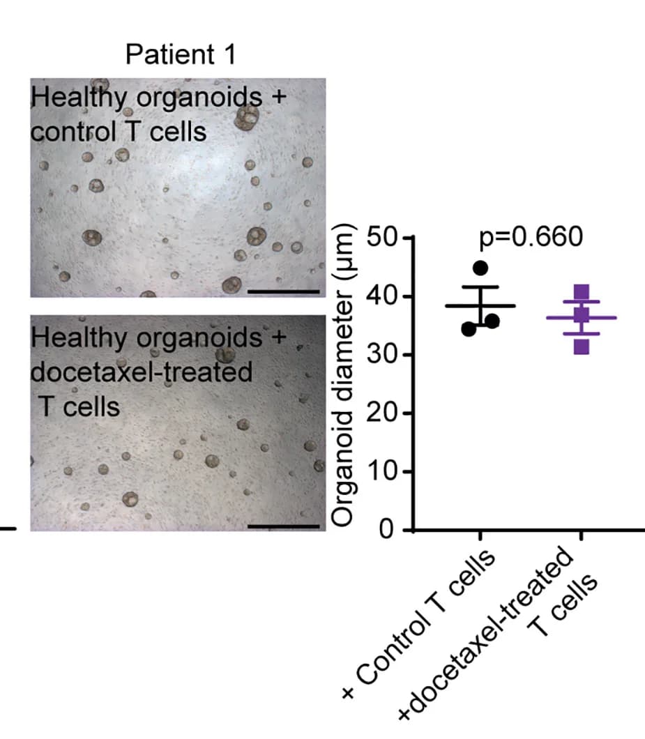 Open access visualization of Microscopy, Error Bars, Organoid Diameter, Lung Healthy Organoids, T Cells